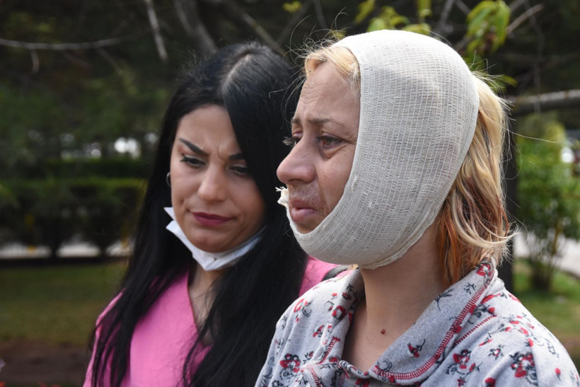 Eskişehir'de 'tek suçum' deyip isyan etti! Köpek beslerken canını zor kurtardı - Resim: 1