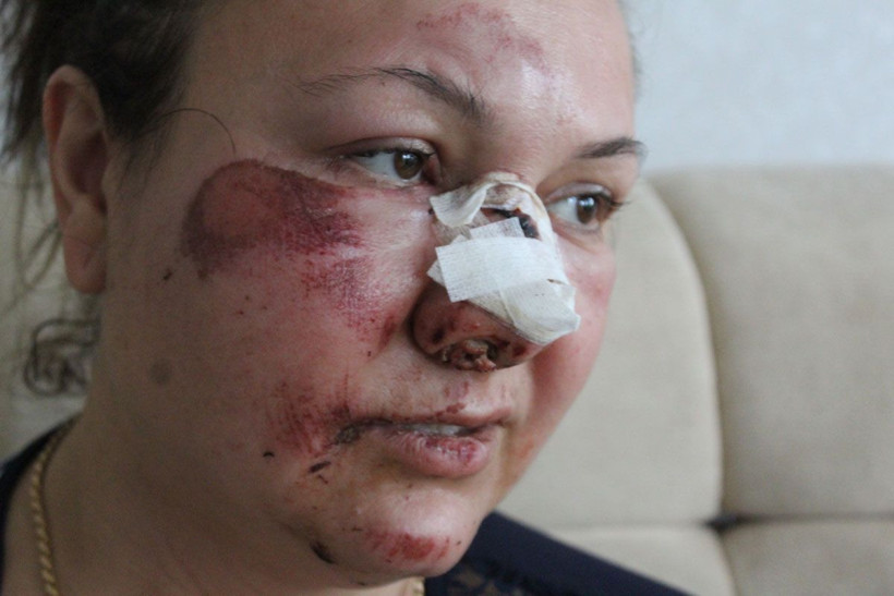 Kanlar içinde gözünü hastanede açtı! Gaziantep'te eski sevgili dehşeti - Resim: 2