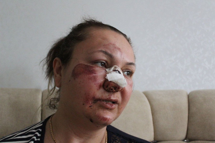 Kanlar içinde gözünü hastanede açtı! Gaziantep'te eski sevgili dehşeti - Resim: 3