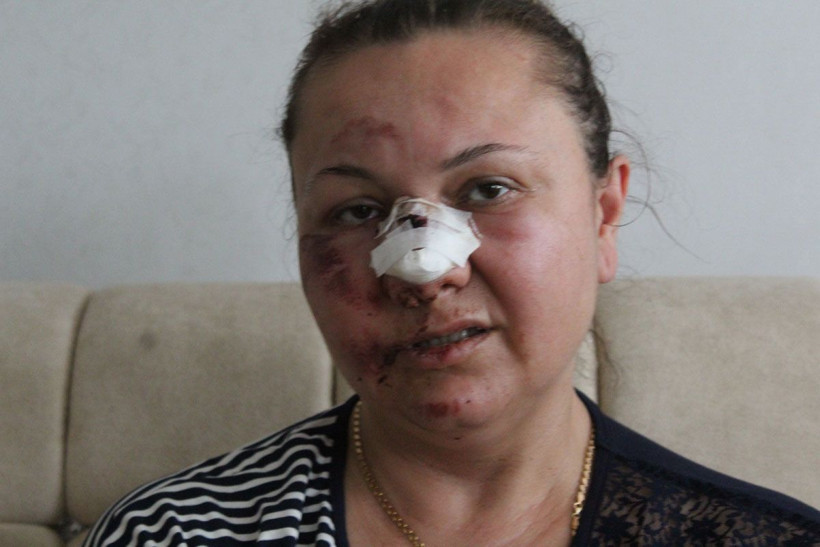 Kanlar içinde gözünü hastanede açtı! Gaziantep'te eski sevgili dehşeti - Resim: 4