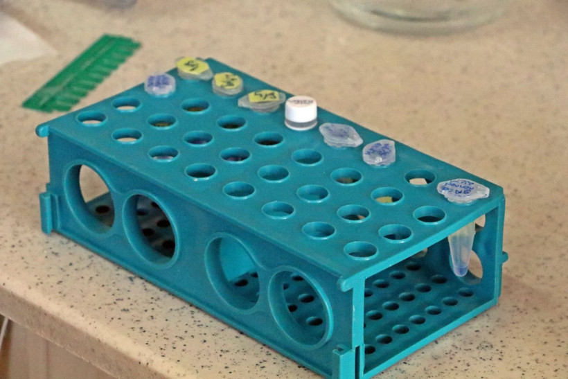 Covid-19'a karşı bitkiden üretildi! 'Kokteyl aşı’ insan deneyine hazır hale geldi - Resim: 4