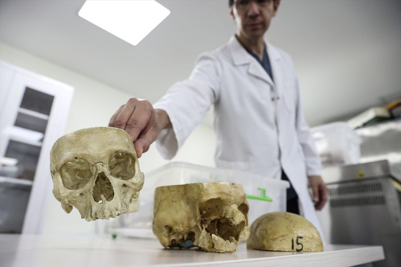 Türkiye kadavra ithal ediyor! Fiyatını duyan inanamadı: Diyanet fetva verdi - Resim: 4