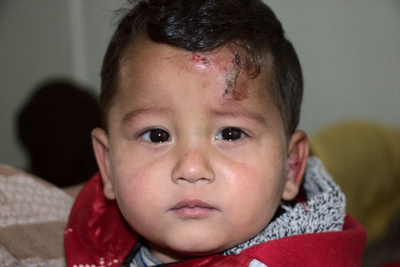 Barış Pınarı bölgesinde korkutan salgın! Özellikler çocukları vuruyor 'şark çıbanı' alarmı - Resim: 1