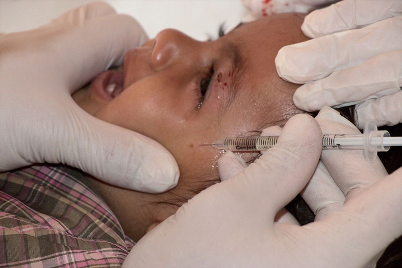 Barış Pınarı bölgesinde korkutan salgın! Özellikler çocukları vuruyor 'şark çıbanı' alarmı - Resim: 2