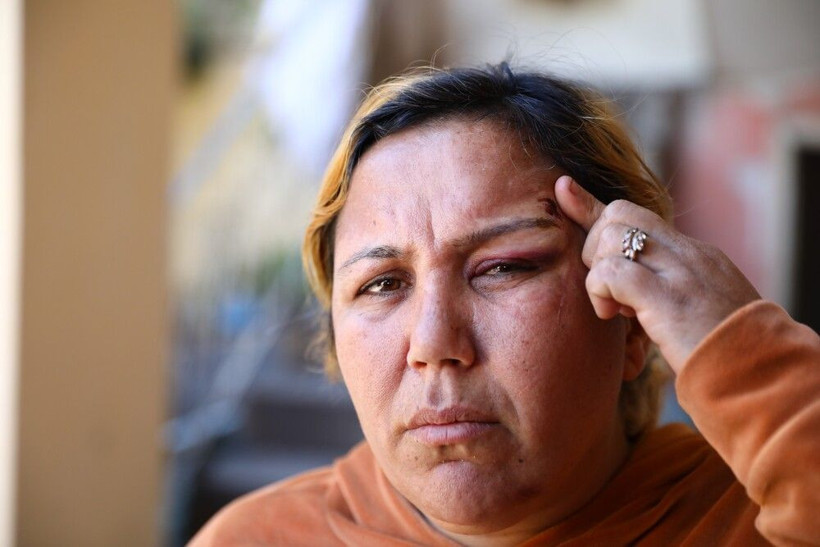 Cinsel şiddet kabusu! 'Kocam gelinliğimi yırtıp birlikte oldu' dedi: Gürültüyü duyan koştu defalarca... - Resim: 2