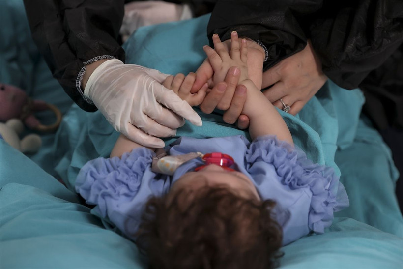 Annesi 16 aylık Galya bebeği hastanede bırakıp kaçtı! Her yeri yanmıştı - Resim: 1