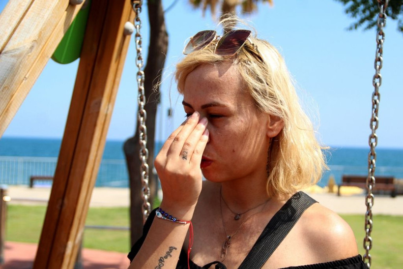 Salıncaktaki iki genç kız öyle bir sebeple darp edildi ki! - Resim: 3