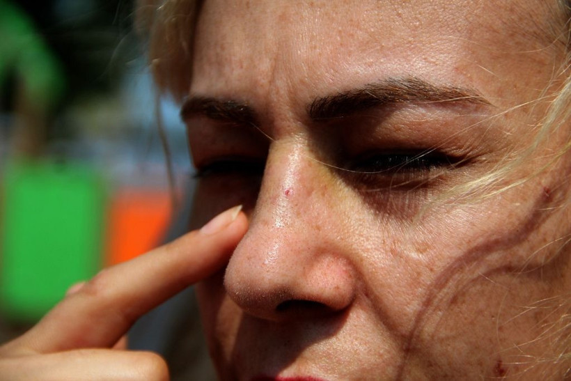 Salıncaktaki iki genç kız öyle bir sebeple darp edildi ki! - Resim: 4