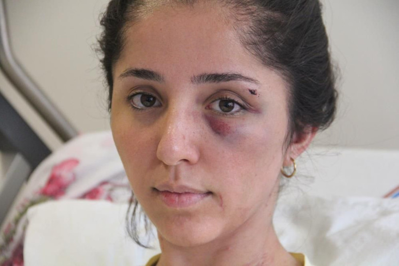 Doktor sevgili Elazığ'da kan dondurdu! Genç kadının akciğeri söndü! Gözlerini oyacağım... - Resim: 2