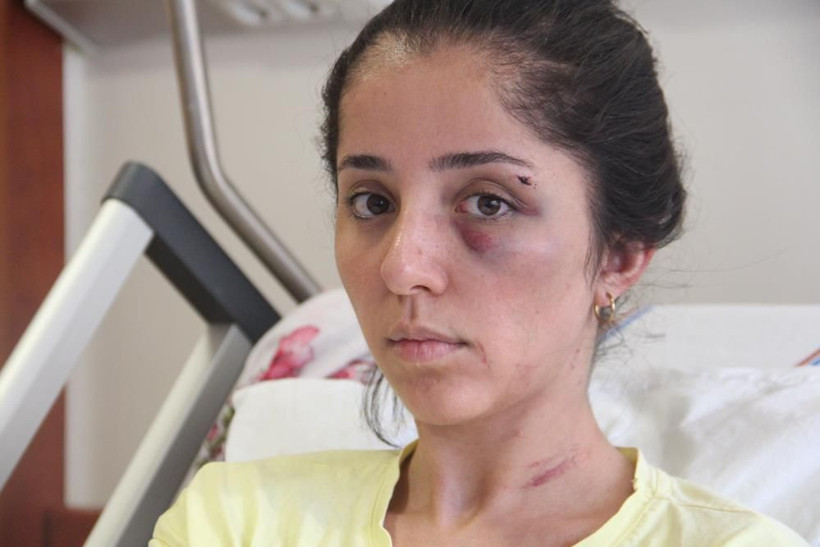 Doktor sevgili Elazığ'da kan dondurdu! Genç kadının akciğeri söndü! Gözlerini oyacağım... - Resim: 1