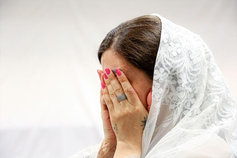 Hepsinin kaderi yüzlerinde saklı... Bu kadın modeller diğerlerinden çok farklı - Resim: 4