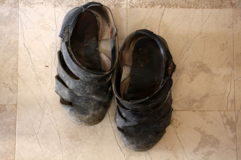 Çok farklı bir hastalığı var ayakları sürekli büyüyor! Sivas'ta bu adamı görenler şoke oluyor - Resim: 4