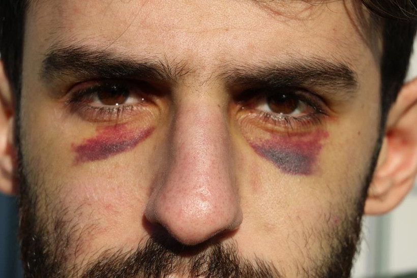 Yunanistan bir kez daha ölüme itti: Soydular, dövdüler, çıplak halde geri gönderdiler - Resim: 1