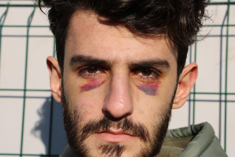 Yunanistan bir kez daha ölüme itti: Soydular, dövdüler, çıplak halde geri gönderdiler - Resim: 3