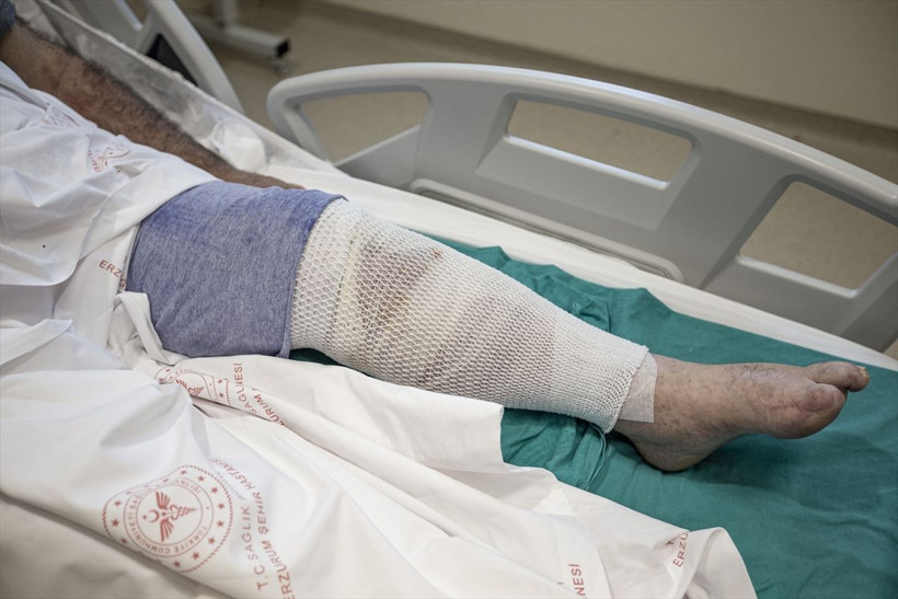 Ağrısını dindirmek için bacaklarına sardı! Gözünü hastanede açtı - Resim: 3