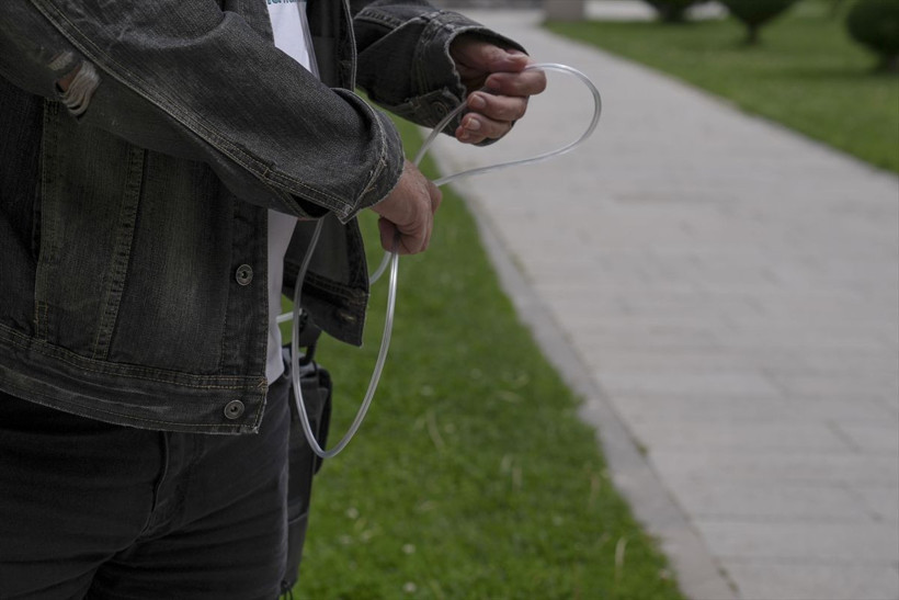 3 yıldır akciğerini çantasında taşıyor: Nefes almanın bu kadar önemli olduğunu bilmiyordum - Resim: 3