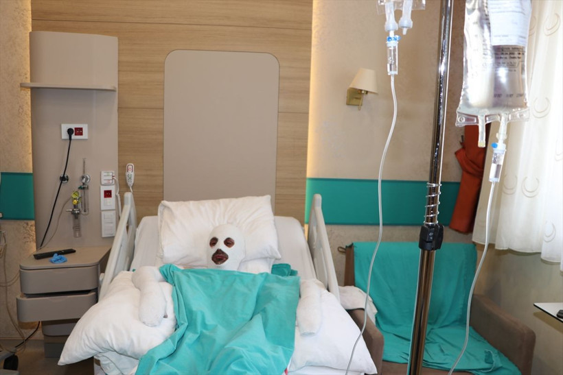 Gazı açıp sohbete dalan döner ustasının başına gelenler feci! - Resim: 3