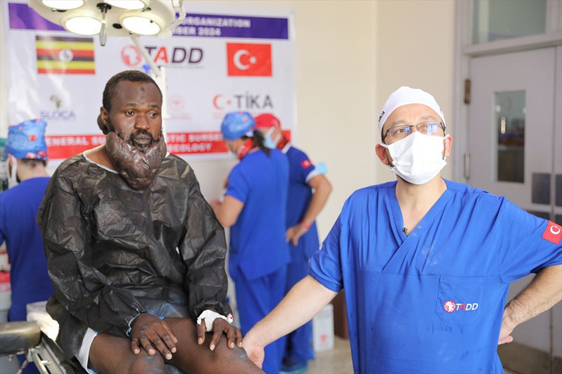 Sakal gibi uzayan 'keloid' şaşkına çevirdi! Ugandalı Muhammed'i Türk doktorlar kurtardı - Resim: 1