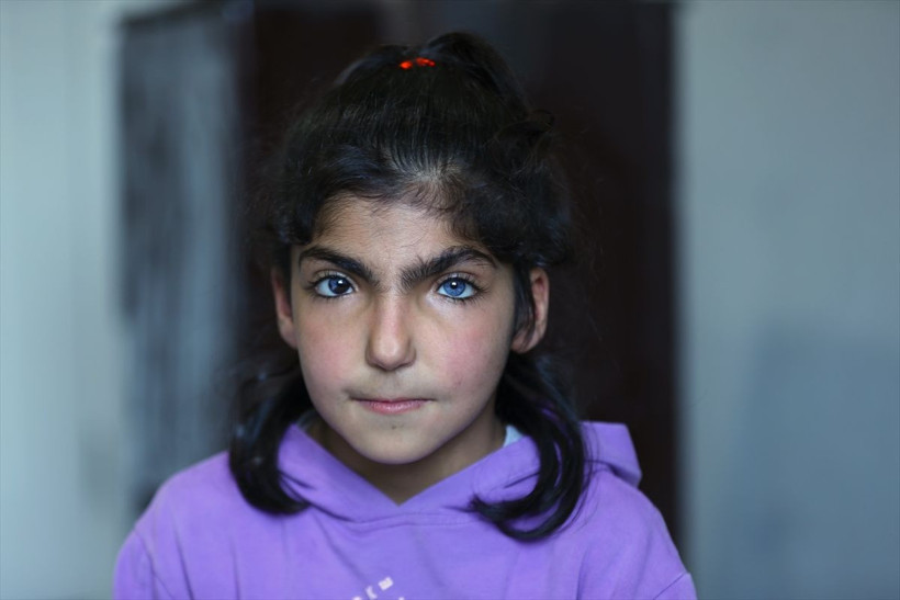 Farklı göz renkleri olan kız kardeşler görenleri şaşırtıyor - Resim: 2