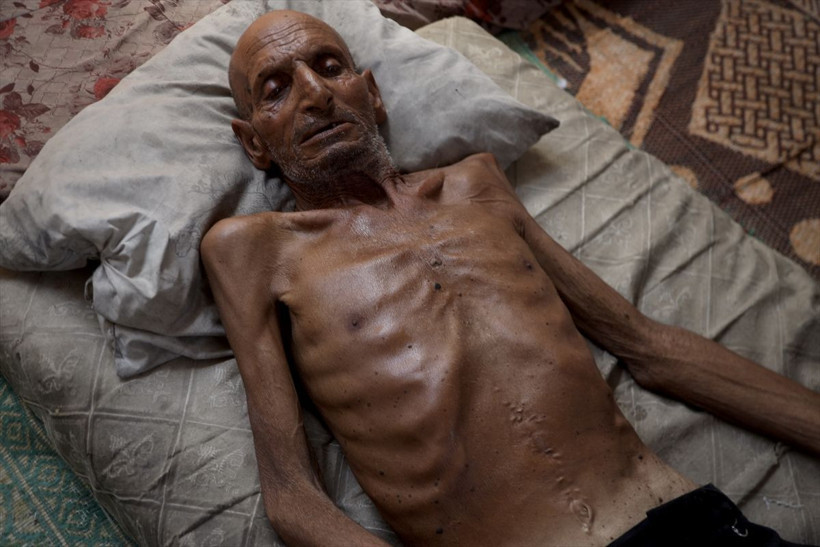 Gazzeli müezzini görenler şoke oluyor 70 kilogramdan bakın kaç kilograma düştü - Resim: 1