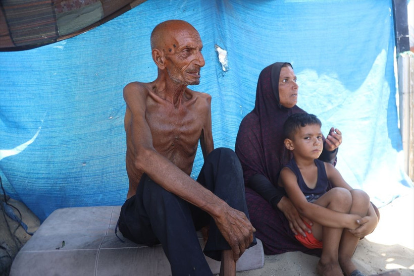 Gazzeli müezzini görenler şoke oluyor 70 kilogramdan bakın kaç kilograma düştü - Resim: 2