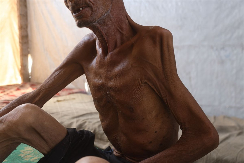 Gazzeli müezzini görenler şoke oluyor 70 kilogramdan bakın kaç kilograma düştü - Resim: 4