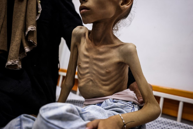 25 kilodan 10 kiloya düştü! Gazzeli Meryem'in son haline yürek dayanmıyor - Resim: 4