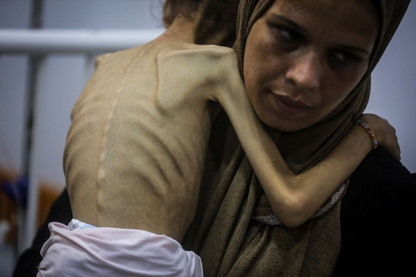 25 kilodan 10 kiloya düştü! Gazzeli Meryem'in son haline yürek dayanmıyor - Resim: 2