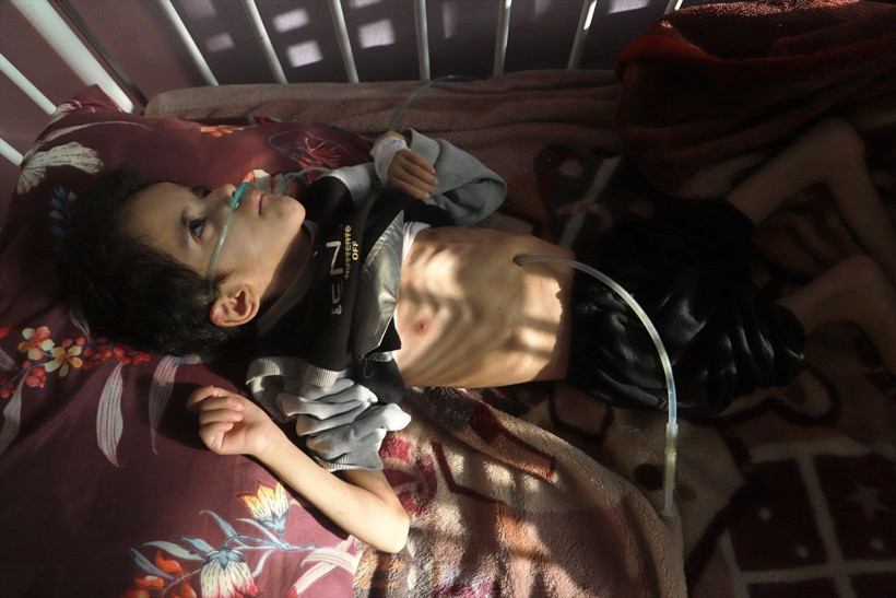 Gazze'de açlık can alıyor! Filistinli çocuklar yaşam mücadelesi veriyor - Resim: 1