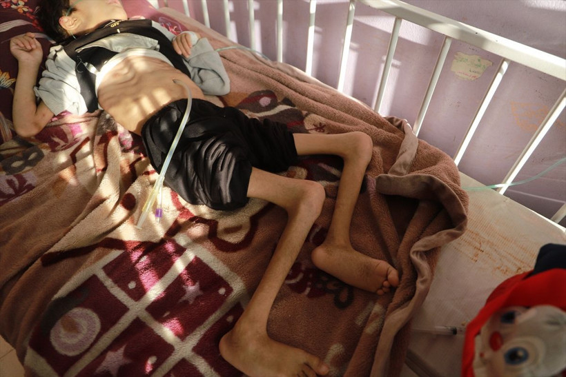 Gazze'de açlık can alıyor! Filistinli çocuklar yaşam mücadelesi veriyor - Resim: 2