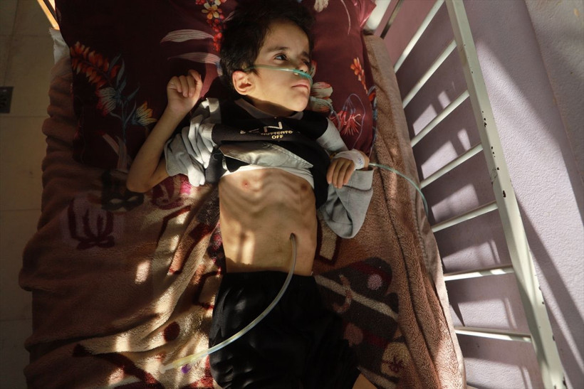 Gazze'de açlık can alıyor! Filistinli çocuklar yaşam mücadelesi veriyor - Resim: 4