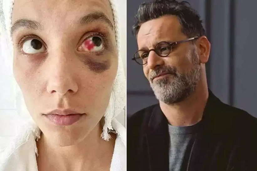 Oyuncu Ozan Güven Deniz Bulutsuz'u darp etmişti! Yıllar sonra kendini savundu... - Resim: 2