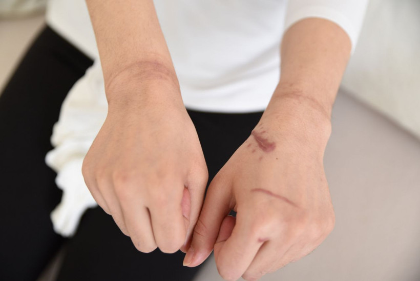 Genç kıza 'sürprizim var' dedi sonrası korkunç - Resim: 4