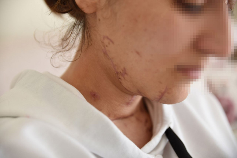 Genç kıza 'sürprizim var' dedi sonrası korkunç - Resim: 2