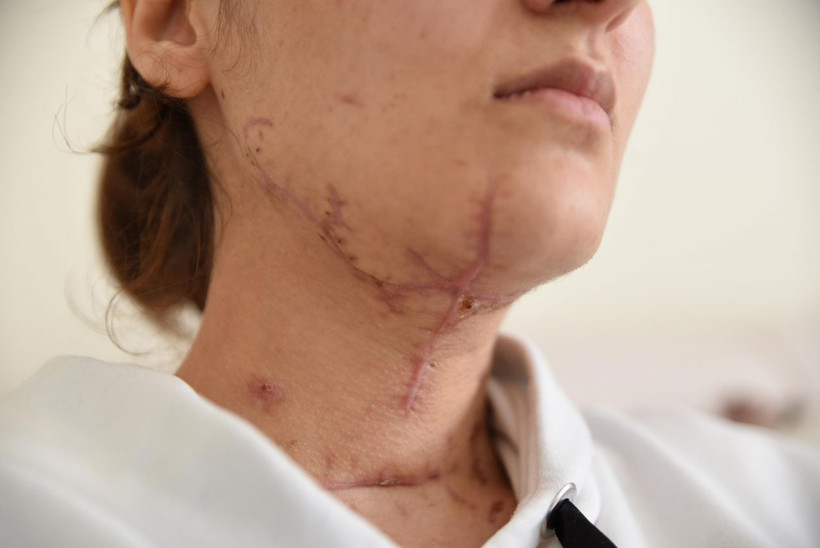 Genç kıza 'sürprizim var' dedi sonrası korkunç - Resim: 3