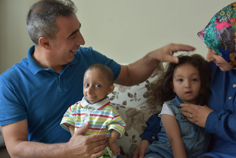 Hastalığı milyonda bir görülüyor gerçek yaşını duyan şaşkına dönüyor - Resim: 4