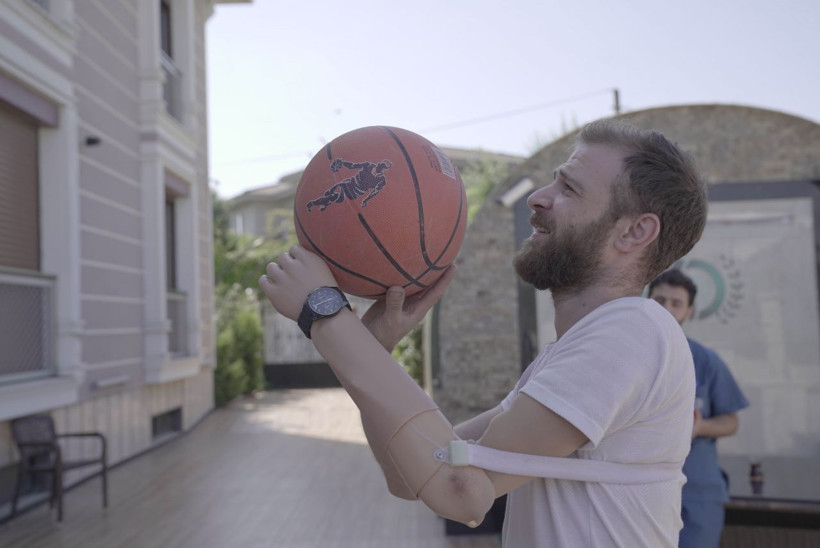 Sokakta yürürken bombanın hedefi oldu, kaybettiği organlarına protezle kavuştu! - Resim: 4