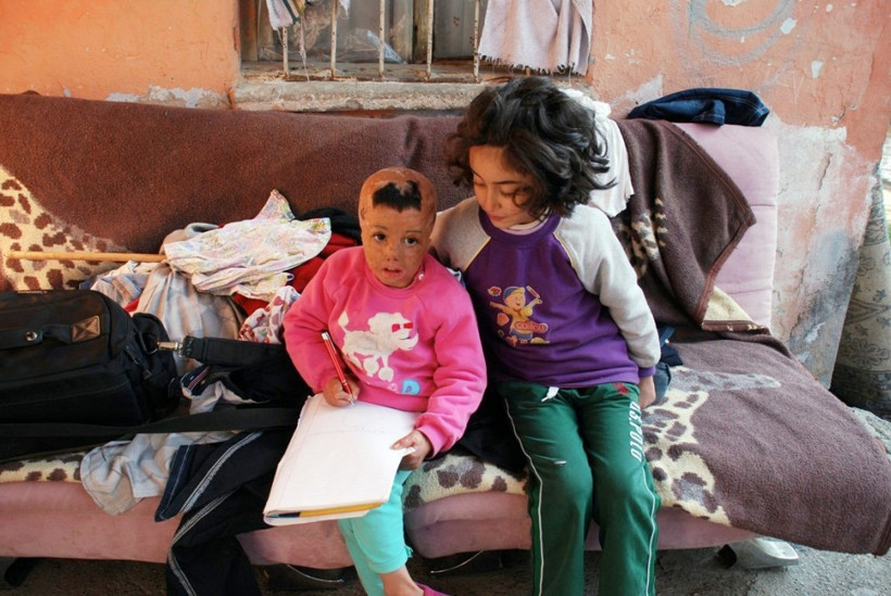 6 yaşında 7 kez ameliyat olan Rezzan'ın dramı - Resim: 2