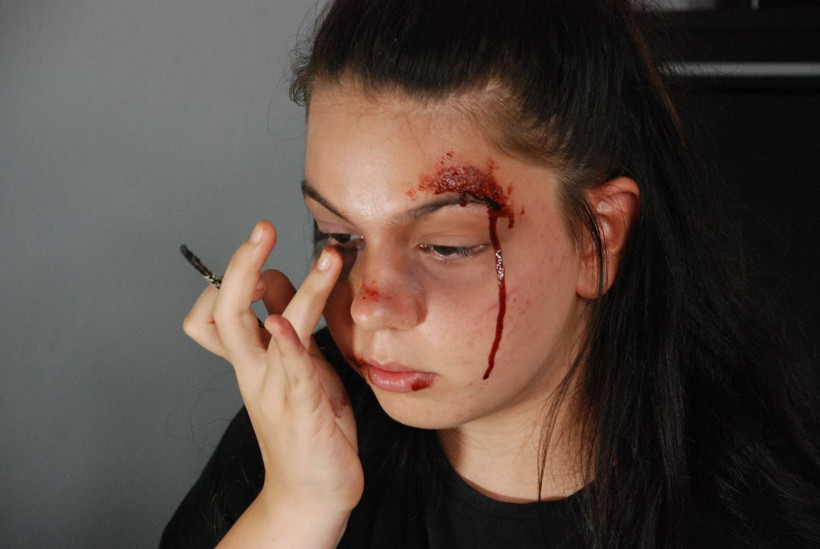 İzmir'de bu genç kızı gören çığlık atıp ambulansı arıyor! - Resim: 1