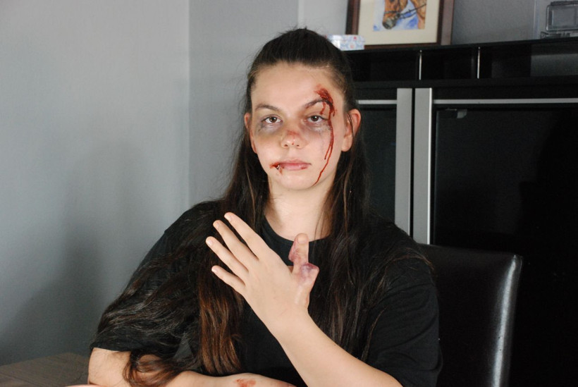 İzmir'de bu genç kızı gören çığlık atıp ambulansı arıyor! - Resim: 3