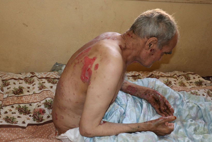 Vücudunu ve ağzının içini saran yaralar kabusu oldu! Suriyeli adamın yürek yakan feryadı - Resim: 1