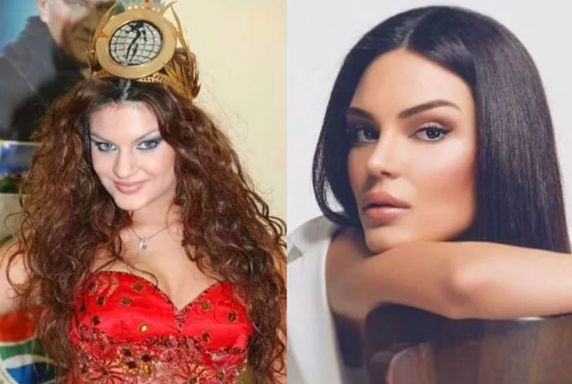 Cansu Dere Demet Özdemir ve Esra Bilgiç'in estetiksiz hallerine bakın - Resim: 2