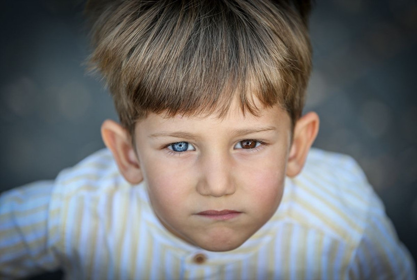 Bursalı iki kardeş Van kedisi gibi gözleriyle herkesi şaşırtıyor - Resim: 2