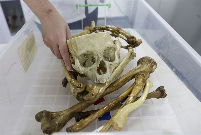 Türkiye kadavra ithal ediyor! Fiyatını duyan inanamadı: Diyanet fetva verdi - Resim: 2