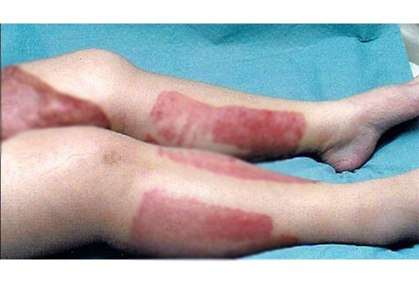 Bikini bölgesini traş etti başına gelmeyen kalmadı - Resim: 2