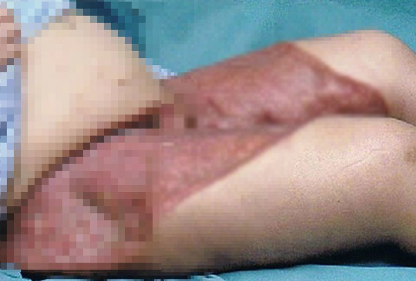 Bikini bölgesini traş etti başına gelmeyen kalmadı - Resim: 3