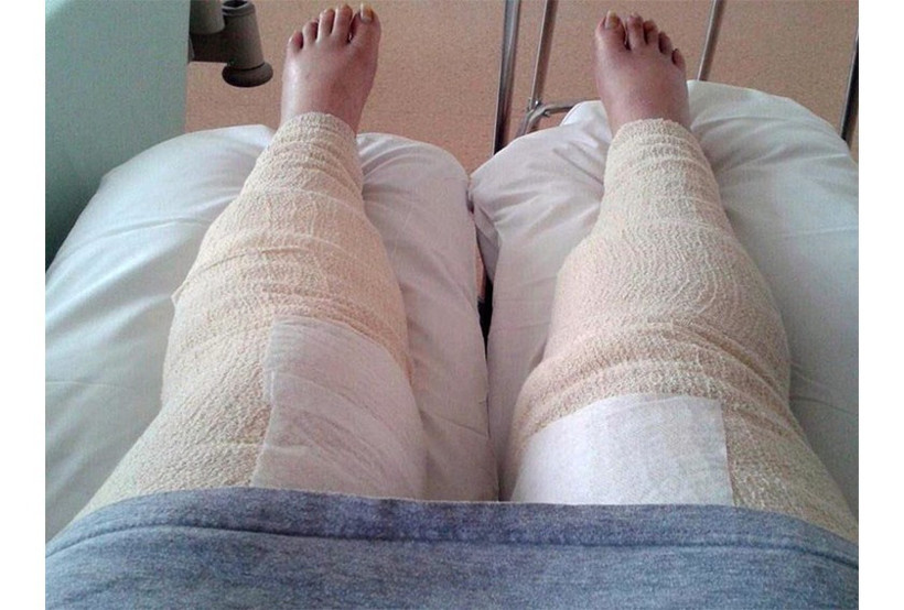 Bikini bölgesini traş etti başına gelmeyen kalmadı - Resim: 4