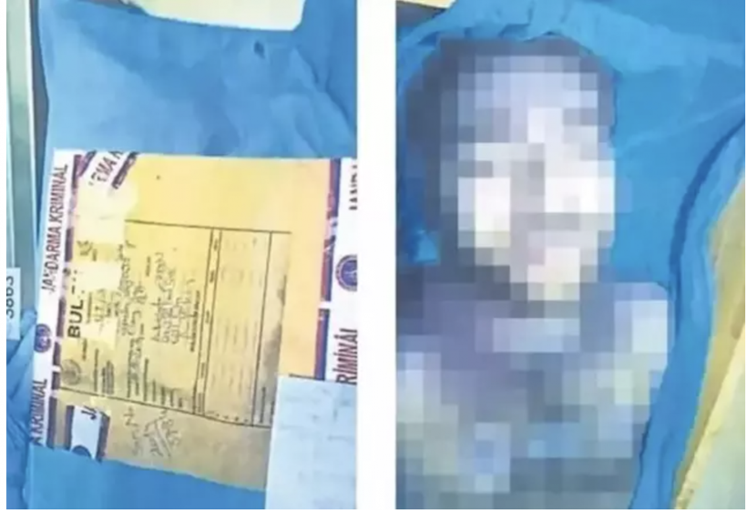 Garipoğlu'nun otopsi fotoğrafları olay olmuştu! Elindeki morlukların sırrı bakın neymiş - Resim: 3