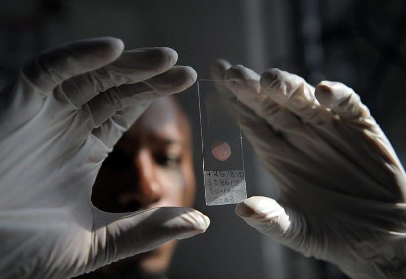 Dünya koronavirüsü konuşuyor ancak sıtma nedeniyle 1 yılda 409 bin kişi öldü! - Resim: 1