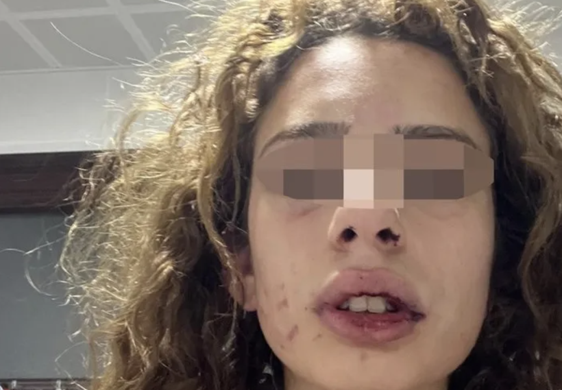 Üniversiteli kıza dehşeti yaşattı! 'Sana bir sürprizim var' dedi sabaha kadar dövdü - Resim: 1